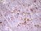 Apolipoprotein B Receptor antibody, M09242, Boster Biological Technology, Immunohistochemistry paraffin image 