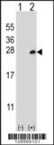 Docking Protein 5 antibody, 56-408, ProSci, Western Blot image 