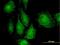 TGF-Beta Activated Kinase 1 (MAP3K7) Binding Protein 1 antibody, H00010454-M03, Novus Biologicals, Immunofluorescence image 