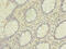 Heterogeneous Nuclear Ribonucleoprotein L antibody, MBS1491998, MyBioSource, Immunohistochemistry paraffin image 