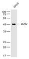 Damage Specific DNA Binding Protein 2 antibody, GTX57218, GeneTex, Western Blot image 