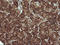 Mitogen-Activated Protein Kinase Kinase 1 antibody, LS-C174487, Lifespan Biosciences, Immunohistochemistry frozen image 