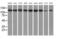 Histone Deacetylase 6 antibody, MA5-25317, Invitrogen Antibodies, Western Blot image 
