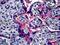 Integrin Subunit Alpha V antibody, LS-B5254, Lifespan Biosciences, Immunohistochemistry paraffin image 