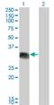 Scm Polycomb Group Protein Like 1 antibody, H00006322-M01, Novus Biologicals, Western Blot image 