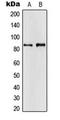 Amyloid Beta Precursor Protein Binding Family A Member 2 antibody, LS-C353891, Lifespan Biosciences, Western Blot image 