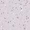 Nucleolar And Coiled-Body Phosphoprotein 1 antibody, NBP2-38625, Novus Biologicals, Immunohistochemistry paraffin image 