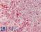 Hexokinase 3 antibody, LS-B14921, Lifespan Biosciences, Immunohistochemistry paraffin image 