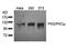 Protein Kinase D1 antibody, orb14533, Biorbyt, Western Blot image 