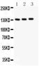 Nitric Oxide Synthase 3 antibody, PA1712-1, Boster Biological Technology, Western Blot image 