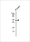 Stathmin 4 antibody, LS-C161573, Lifespan Biosciences, Western Blot image 
