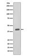 Casein Kinase 2 Alpha 1 antibody, M02398, Boster Biological Technology, Western Blot image 