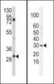 Snail Family Transcriptional Repressor 2 antibody, PA5-11922, Invitrogen Antibodies, Western Blot image 