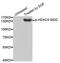 Histone Deacetylase 4 antibody, MBS128538, MyBioSource, Western Blot image 