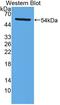 Lysophosphatidylcholine acyltransferase 1 antibody, LS-C373500, Lifespan Biosciences, Western Blot image 