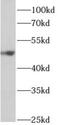 Aldehyde Dehydrogenase 5 Family Member A1 antibody, FNab00297, FineTest, Western Blot image 