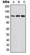 ETAA1 Activator Of ATR Kinase antibody, MBS821215, MyBioSource, Western Blot image 