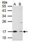 Survivin antibody, PA5-27087, Invitrogen Antibodies, Western Blot image 