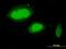 WD Repeat Containing Antisense To TP53 antibody, H00055135-M04, Novus Biologicals, Immunofluorescence image 