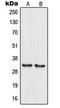 IKAROS Family Zinc Finger 1 antibody, orb340787, Biorbyt, Western Blot image 