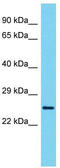 Variable Charge X-Linked 3A antibody, TA331913, Origene, Western Blot image 