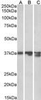 Arginase 1 antibody, orb20124, Biorbyt, Western Blot image 