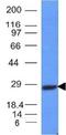 Alpha-Methylacyl-CoA Racemase antibody, orb388130, Biorbyt, Western Blot image 