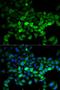 UBE2C antibody, LS-C334094, Lifespan Biosciences, Immunofluorescence image 