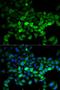 Ubiquitin Conjugating Enzyme E2 C antibody, LS-C334094, Lifespan Biosciences, Immunofluorescence image 