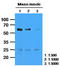 Calsequestrin-2 antibody, LS-C139555, Lifespan Biosciences, Western Blot image 