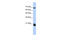 Coiled-Coil-Helix-Coiled-Coil-Helix Domain Containing 4 antibody, 26-623, ProSci, Enzyme Linked Immunosorbent Assay image 