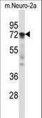 Protein Kinase C Zeta antibody, LS-C164554, Lifespan Biosciences, Western Blot image 