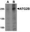 Autophagy Related 2B antibody, orb137351, Biorbyt, Western Blot image 