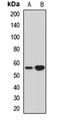 THUMP Domain Containing 3 antibody, LS-C668353, Lifespan Biosciences, Western Blot image 