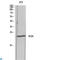 Inducible T Cell Costimulator antibody, LS-C813433, Lifespan Biosciences, Western Blot image 