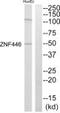 Zinc Finger Protein 446 antibody, PA5-39576, Invitrogen Antibodies, Western Blot image 