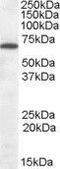 Cannabinoid Receptor 1 antibody, GTX89458, GeneTex, Western Blot image 