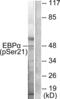 CCAAT Enhancer Binding Protein Alpha antibody, abx012419, Abbexa, Western Blot image 