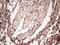 Galectin 3 antibody, LS-C798173, Lifespan Biosciences, Immunohistochemistry paraffin image 