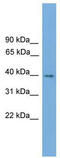 Transmembrane Protein 130 antibody, TA329620, Origene, Western Blot image 