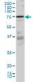 Protein Kinase C Iota antibody, H00005584-M02, Novus Biologicals, Western Blot image 
