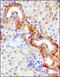 Solute Carrier Family 2 Member 9 antibody, NBP1-06271, Novus Biologicals, Immunohistochemistry frozen image 