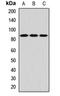Serine/threonine-protein kinase tousled-like 2 antibody, LS-C668105, Lifespan Biosciences, Western Blot image 