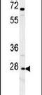 C-X-C Motif Chemokine Receptor 3 antibody, PA5-23679, Invitrogen Antibodies, Western Blot image 