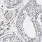 Myoferlin antibody, PA5-53134, Invitrogen Antibodies, Immunohistochemistry paraffin image 