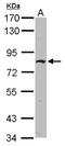 Zinc Finger Protein 326 antibody, NBP2-20992, Novus Biologicals, Western Blot image 