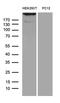 Sperm Associated Antigen 5 antibody, LS-C792468, Lifespan Biosciences, Western Blot image 