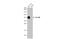 Epithelial Cell Adhesion Molecule antibody, GTX636759, GeneTex, Western Blot image 