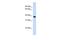 Acyl-CoA Binding Domain Containing 4 antibody, GTX45977, GeneTex, Western Blot image 