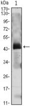 Parathyroid Hormone antibody, M00208-1, Boster Biological Technology, Western Blot image 